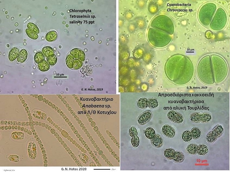 Ερευνητικό Algvision-Μικροσκοπικές φωτογραφίες κυττάρων